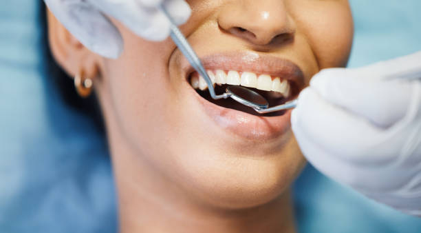 Best Emergency Denture Repair in Tukwila, WA